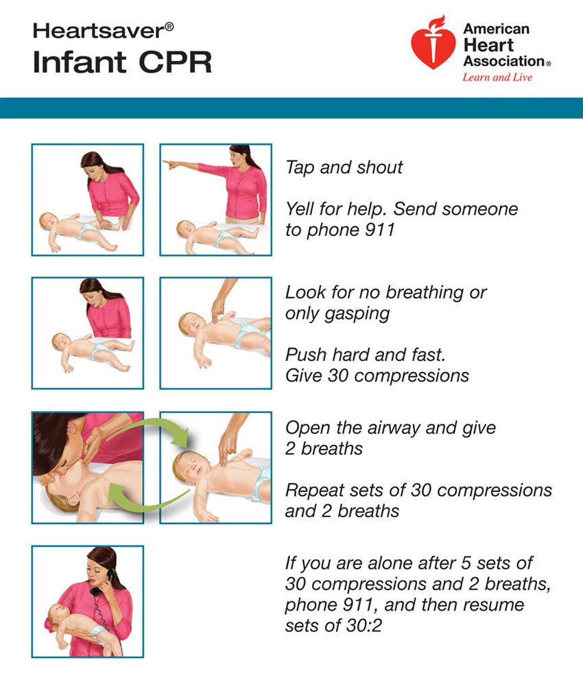 infant cpr1